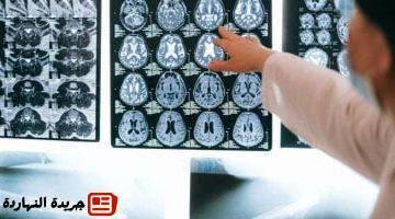 ذكاء اصطناعى تكتشف 9 أنواع من الخرف من فحص