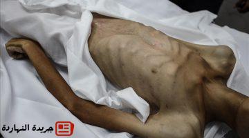 غزة.. ارتفاع وفيات التجويع الإسرائيلي لـ180 بينهم 93 طفلا