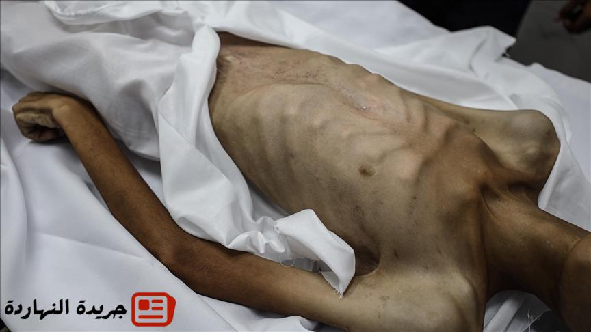 غزة.. ارتفاع وفيات التجويع الإسرائيلي لـ180 بينهم 93 طفلا 5 غزة.. ارتفاع وفيات التجويع الإسرائيلي لـ180 بينهم 93 طفلا